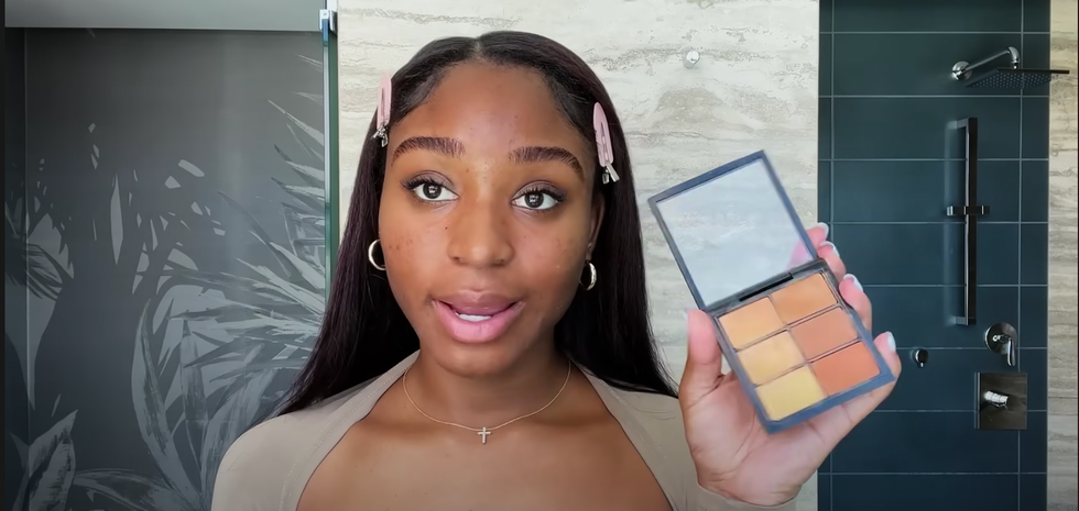 Normani, Akneye Meyilli Cildi İçin Çalışan Güzellik Rutinini Bıraktı 4 img