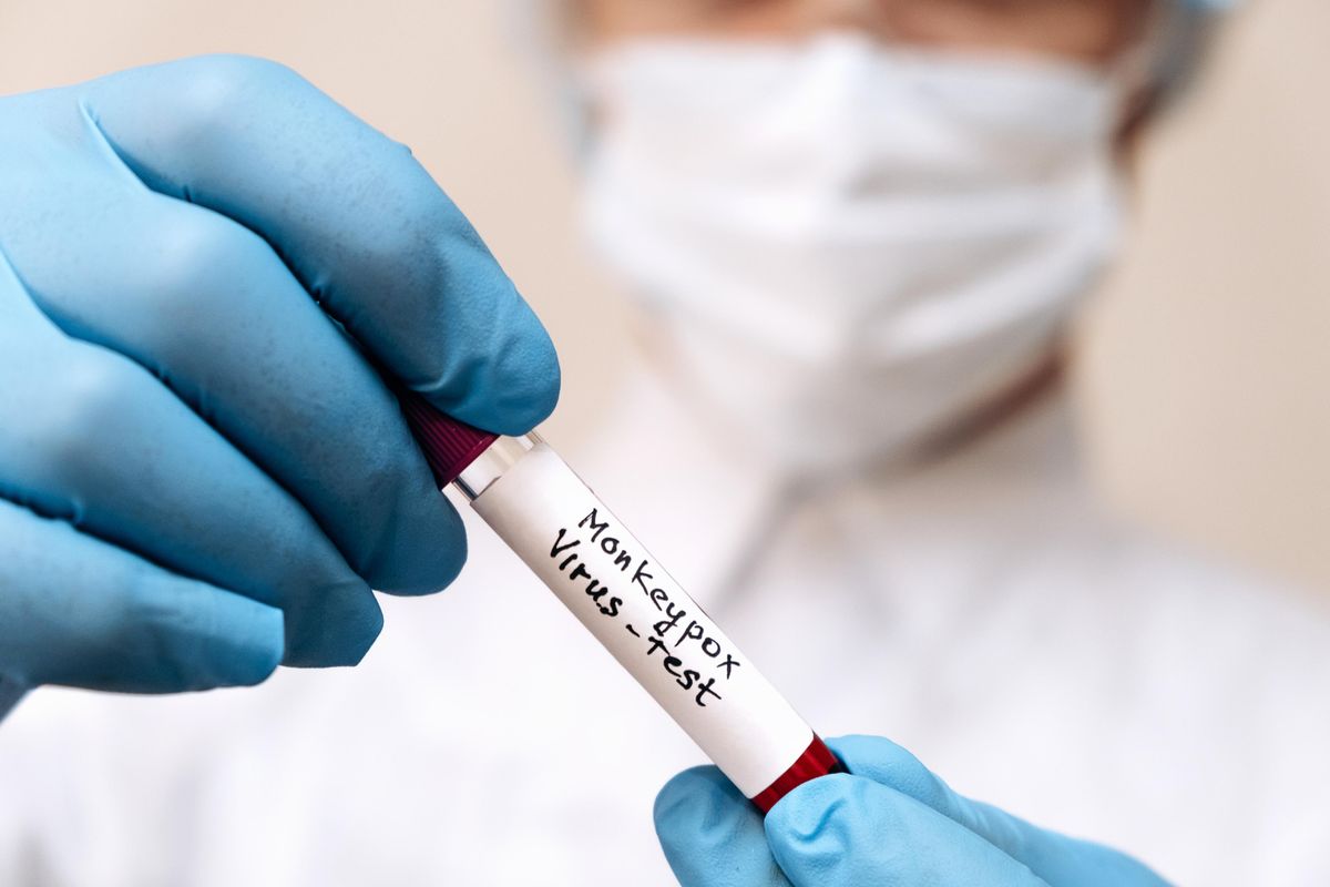 Il sesso gay è un detonatore di pericoli per la salute. E non c’è solo il monkeypox