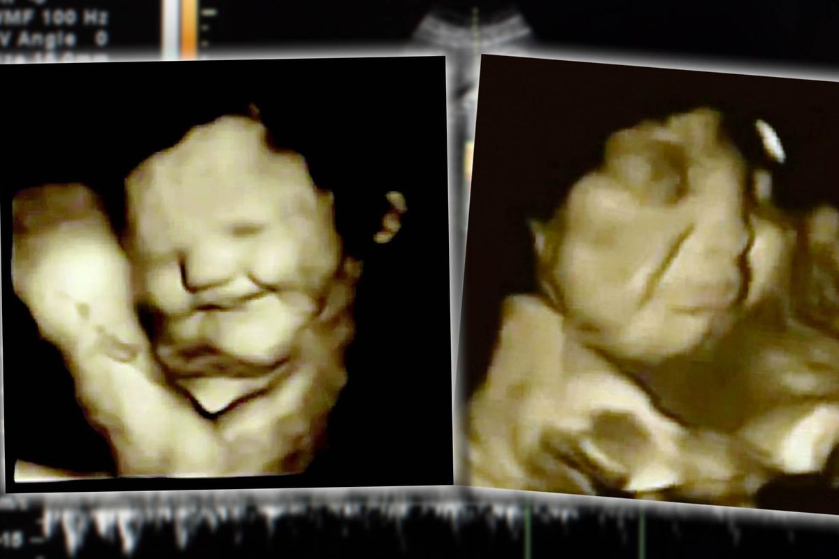 Il feto sorride se assaggia la carota.  Ma per tutti «l’aborto non si tocca»