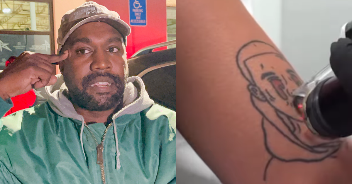 Ye; tattoo of Ye being removed