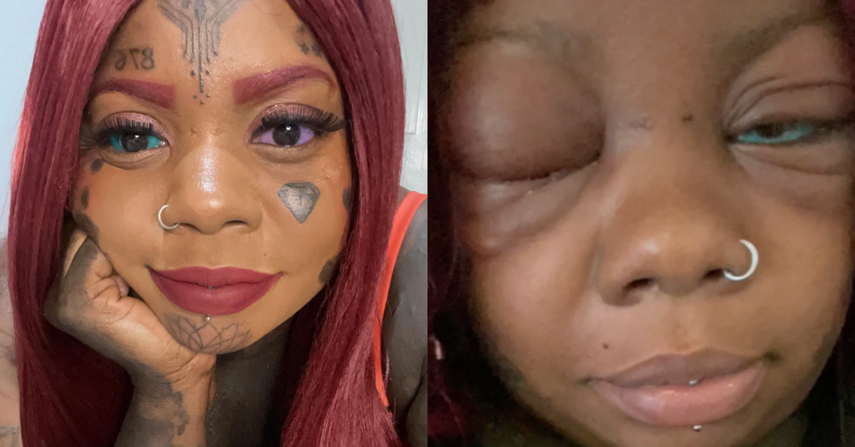 Womans Blue Eyeball Tattoo Leaves Her Blind