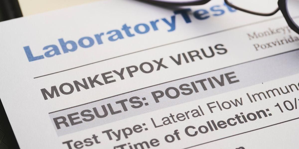 Ways to Speed Up Your Labcorp Test Results
