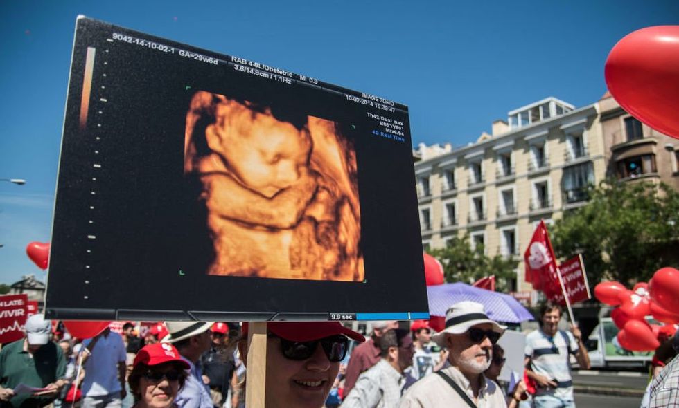 Doctor’s post celebrating abortion is so ghoulish that even pro-choice people turn against her: ‘A family value’ Doctor’s post celebrating abortion is so ghoulish that even pro-choice people turn against her: ‘A family value’