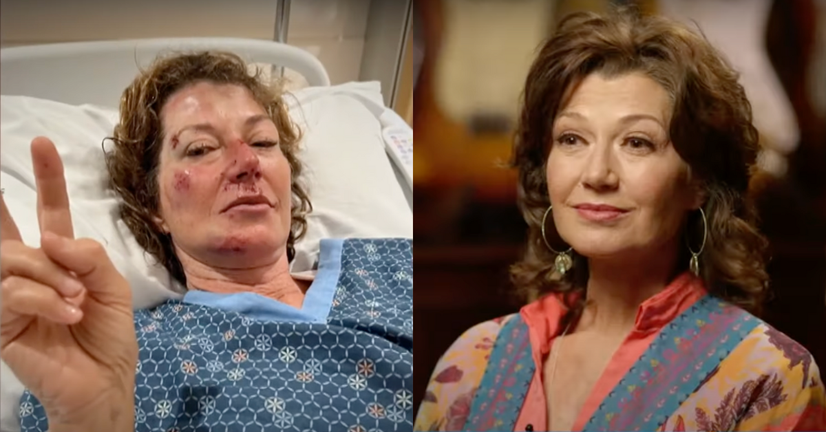 A split image with singer Amy Grant lying in a hospital bed with bruises on her face holding up a peace sign on the left and Amy Grant sitting comfortably on a TV set for an interview on the right, visible injuries completely healed