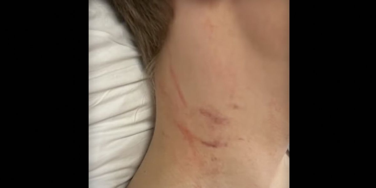 NextImg:Female school bus driver accused of choking middle school boy who has special needs: 'Put her hands around his neck and started squeezing and scratching'