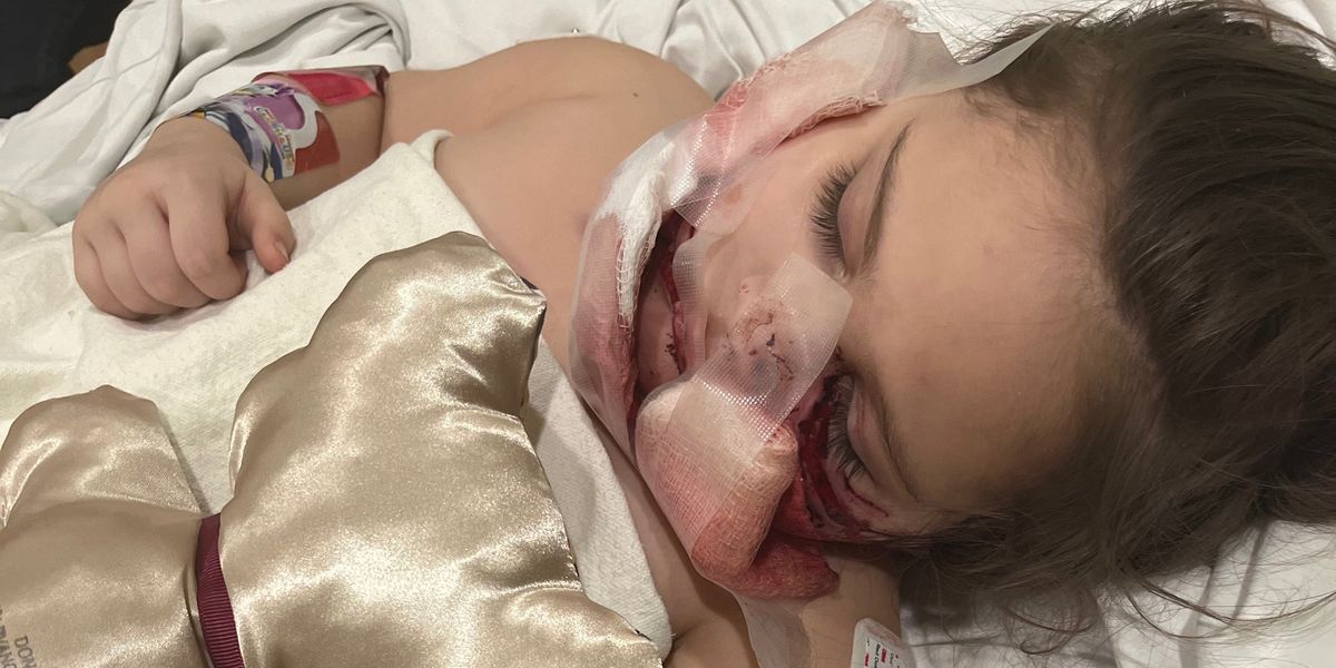 NextImg:3-year-old Louisiana girl may never smile again after being mauled by foster dog that ate toddler's face: 'She was being thrown all over the place'