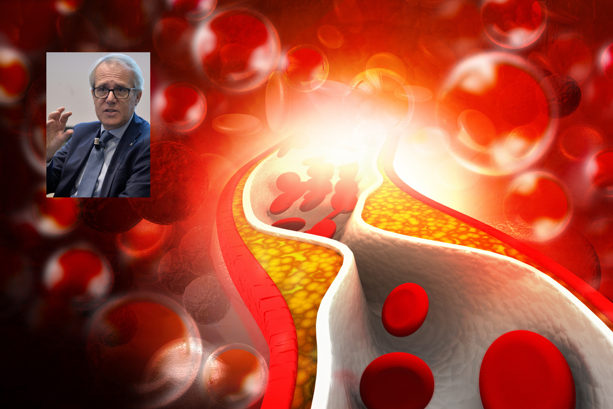 «Dieta sana, niente fumo e un occhio alla bilancia. Così si può sconfiggere il colesterolo in eccesso»