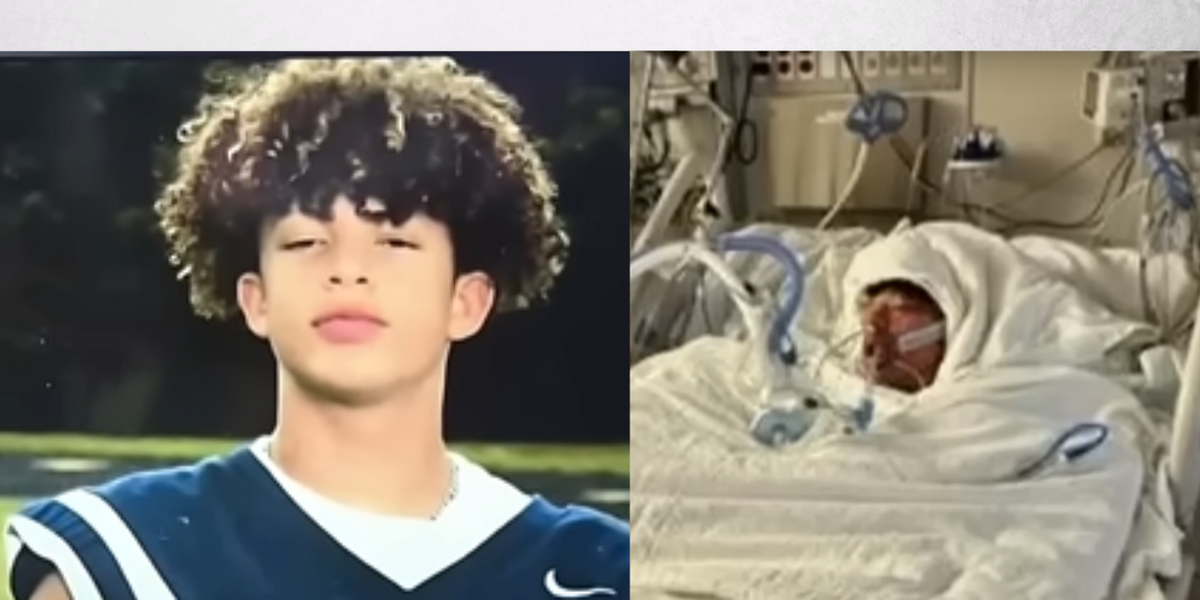 NextImg:'Unrecognizable': Boy burned over 76% of his body after dangerous TikTok challenge
