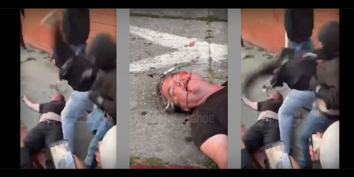 NextImg:Horrific video: Man beaten to bloody pulp by masked thugs angry he confronted their dangerous intersection takeover