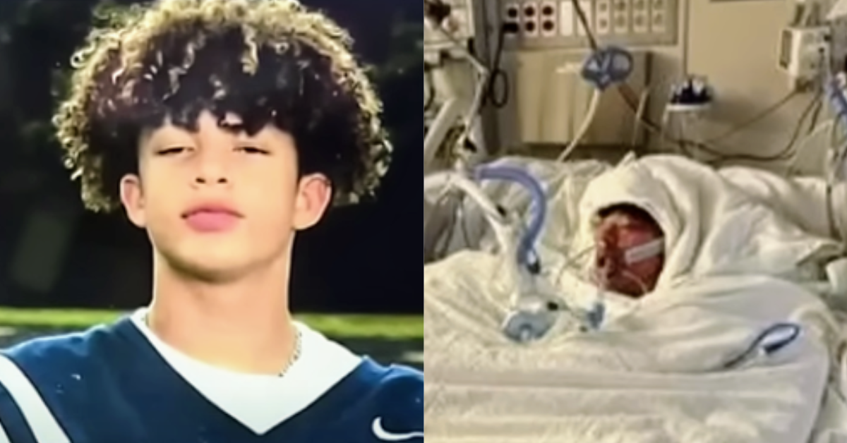 Mason Dark in his football uniform; Mason Dark in the hospital burn unit