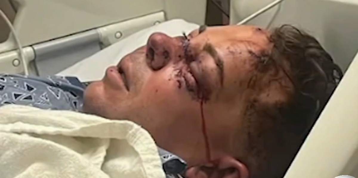 NextImg:'They almost killed him': Store owner's skull fractured, his blood smeared across floor after armed robbers brutally beat him