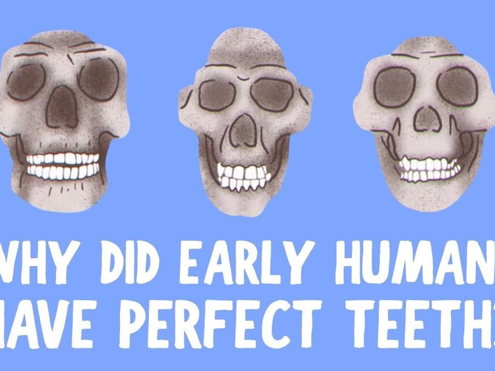 El video explica por qué los primeros humanos tenían naturalmente los dientes rectos y nosotros no.