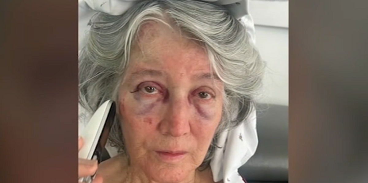 Grandmother beaten at California bus stop, falls into road from random attack