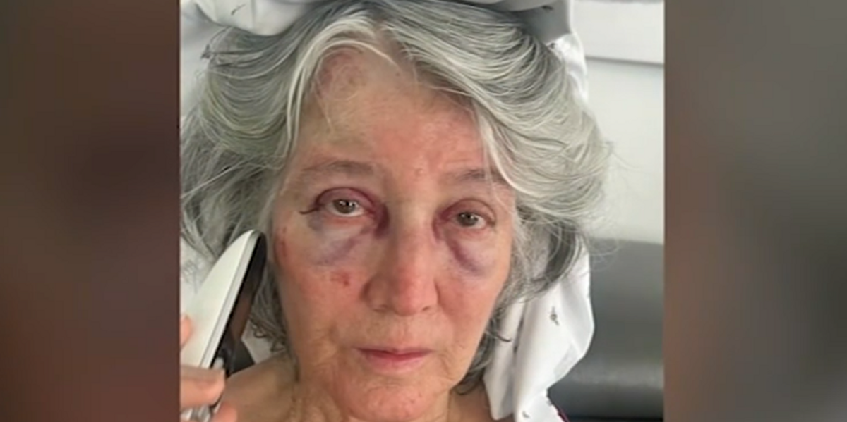 NextImg:Grandmother beaten at California bus stop, falls into road from random attack
