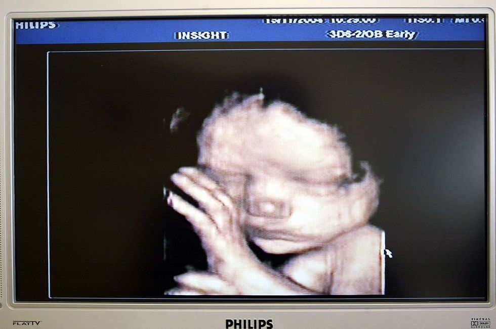 Judge temporarily blocks South Carolina's abortion ban