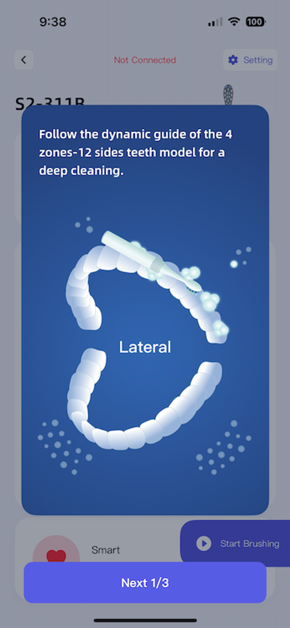 a screenshot of the dynamic guide for brushing your teeth with Bitvae S2 Smart Electric Toothbrush