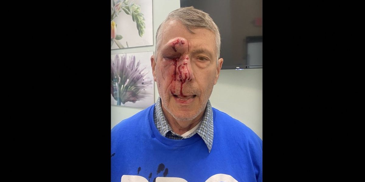 NextImg:Elderly pro-lifer beaten to a pulp in vicious attack outside Planned Parenthood; another elderly pro-lifer knocked out cold in same attack, witness says