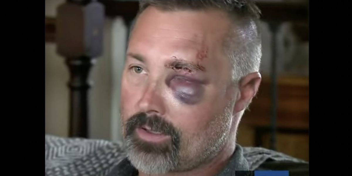 'I thought he was going to die': Man savagely stomped by group of males in front of his wife, needs stitches to reattach eyelid