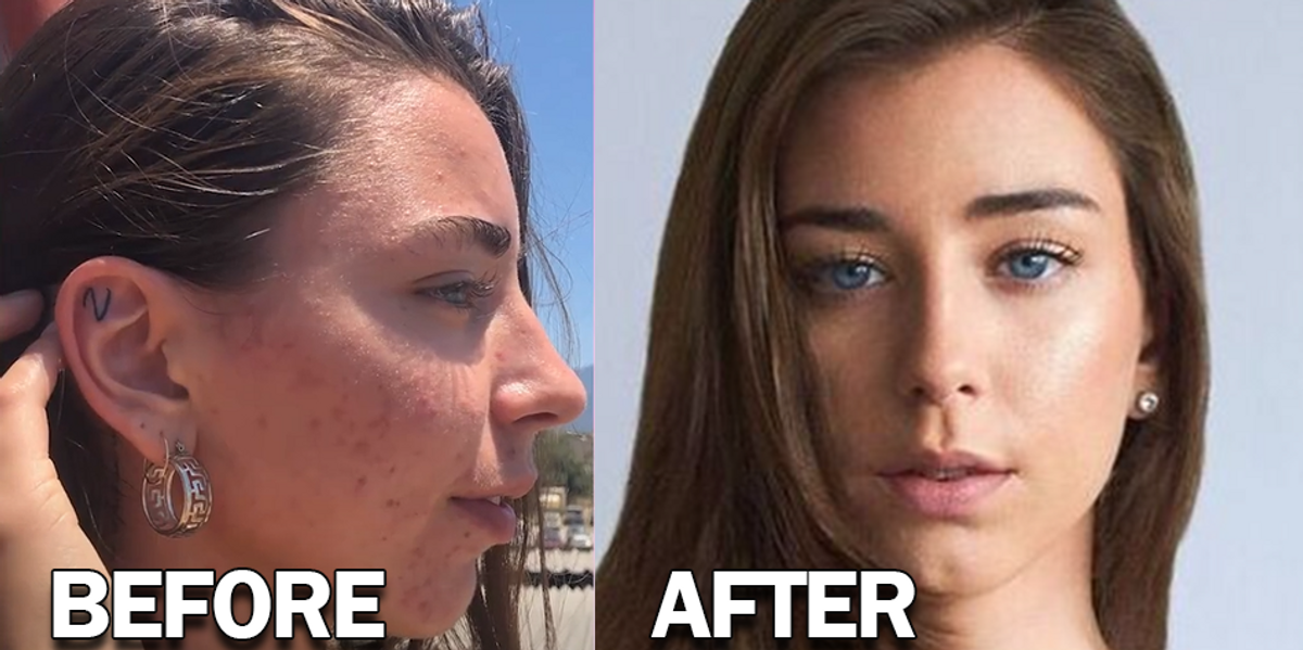 NextImg:'I almost died': 'Diehard vegan' quits diet after California regimen destroyed her health — 'I couldn't even function'