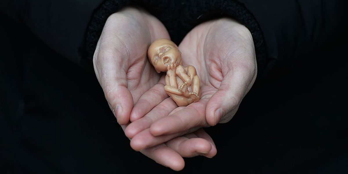 NextImg:OBGYN draws analogy between abortion and a person removing a bug that creeps into their ear