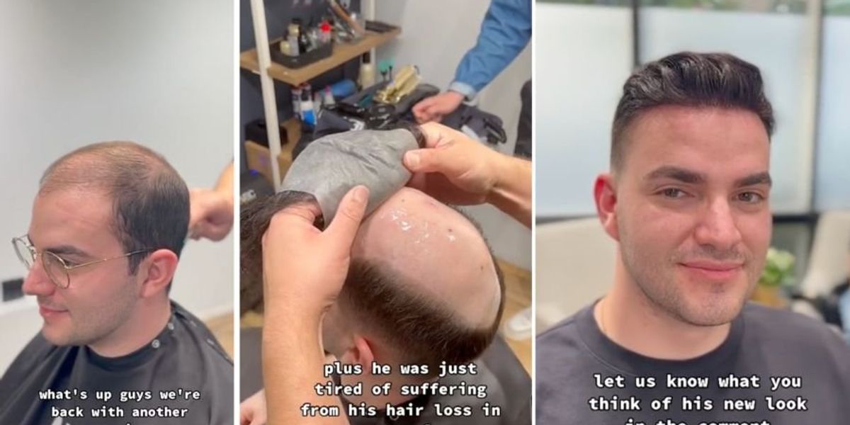 Toupees are popular thanks to TikTok Upworthy