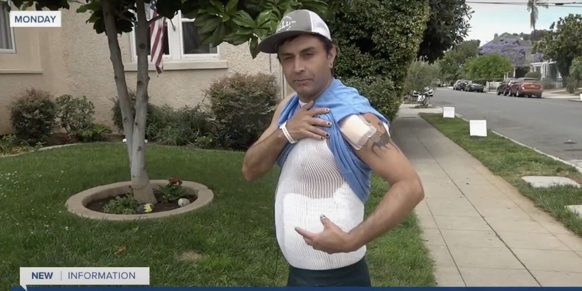NextImg:Gay man claimed he was set on fire in hate-crime attack; but cops say video shows him beating up pregnant woman — who fought back with flame