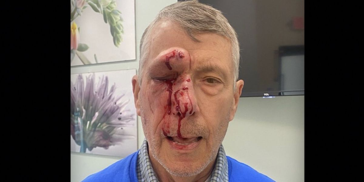 NextImg:Cops release surveillance images of man believed to be in his 20s who brutally punched, kicked face of elderly pro-lifer outside Planned Parenthood
