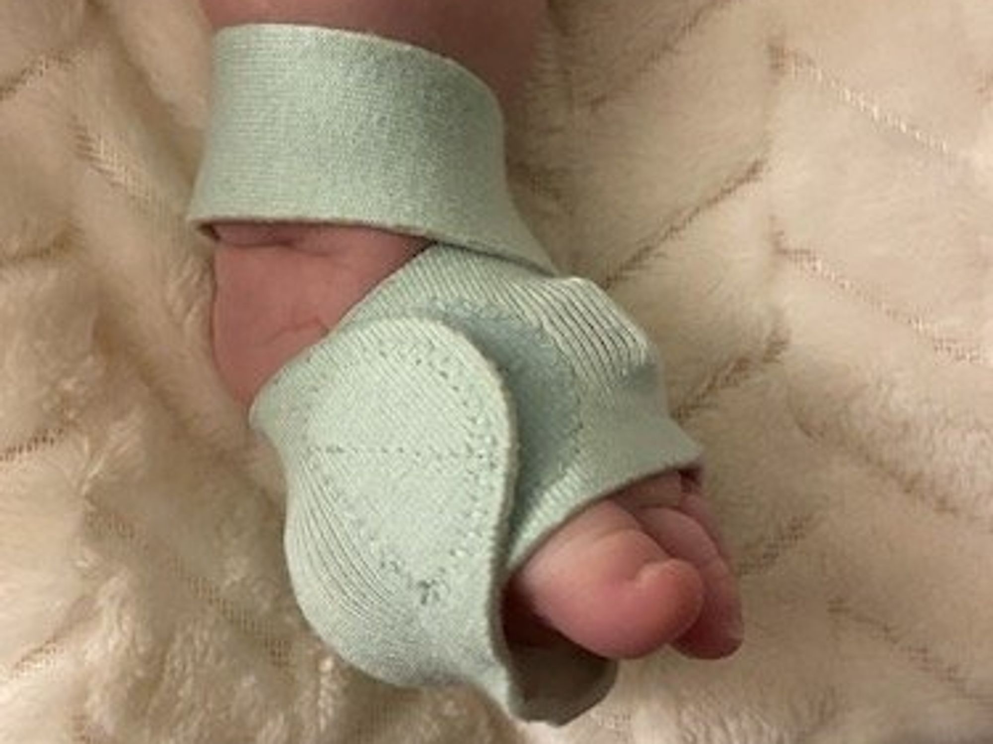 a photo of owlet sock on a baby's foot