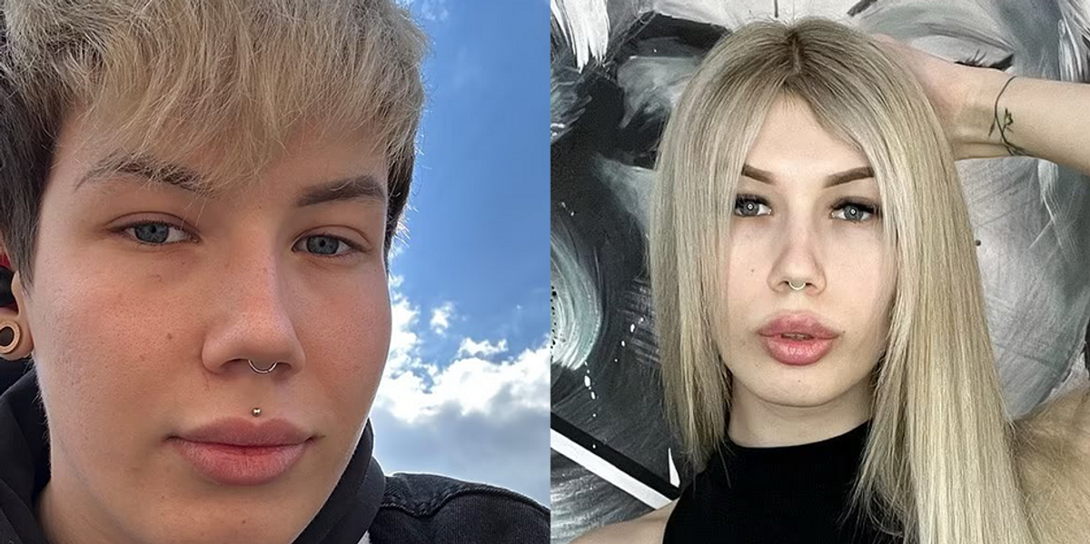 NextImg:Man de-transitions, says transgender surgery should be banned: 'The surgery destroyed my life'