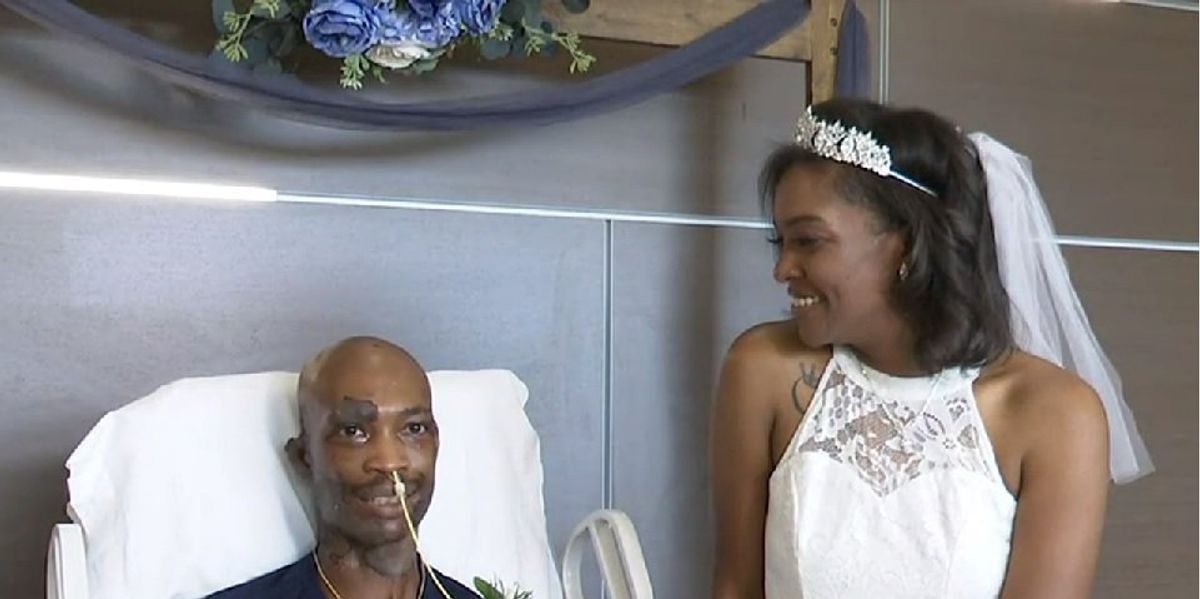 Groom-to-be worried that fiancée wouldn't marry him after he suffered serious chemical burns — but she never wavered: 'There’s nothing that would stop me'