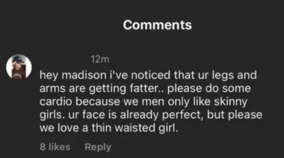 Madison Beer Rips IG Troll Telling Her She's 'Getting Fatter' PHOTOS