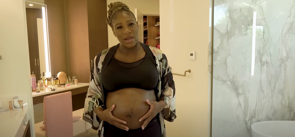 Serena Williams Used Bio-Oil Body Oil for Pregnancy Stretch Marks