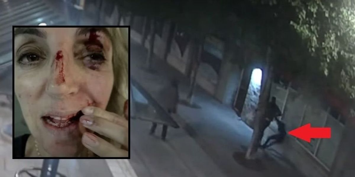 NextImg:Oregon doctor blames 'defunding the police' movement after 'homeless' suspect hurls metal bottle at her head, knocking her out