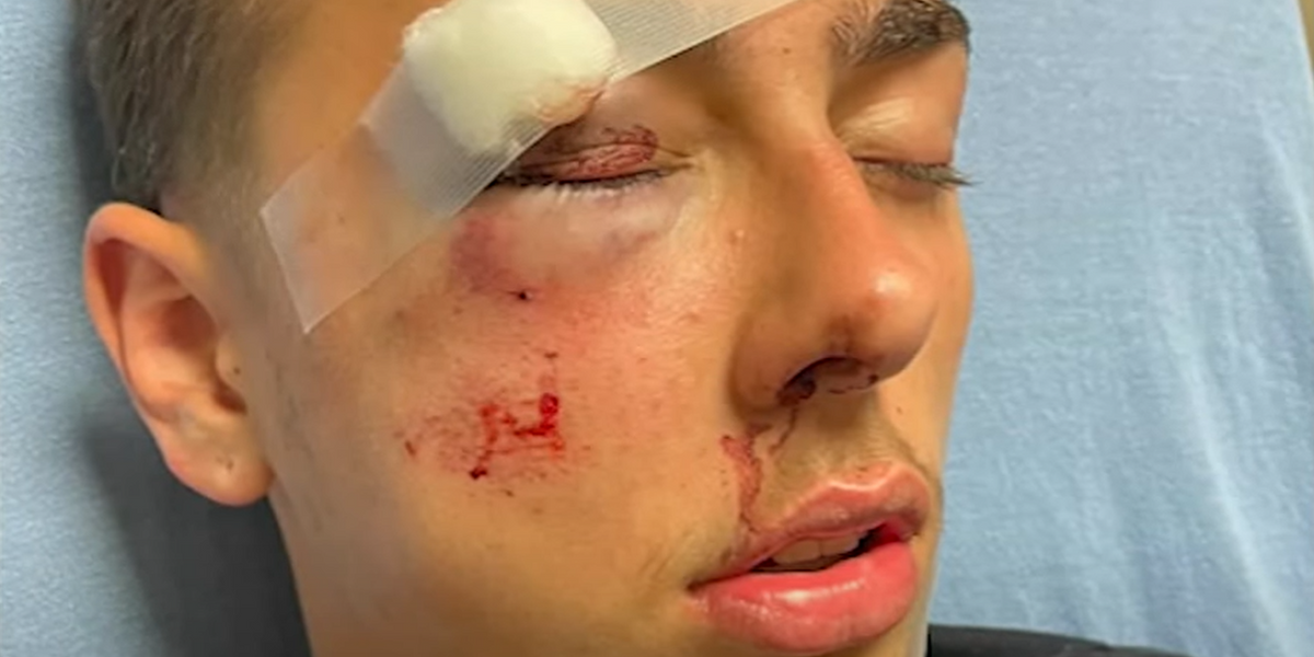 NextImg:Teen hospitalized after Delaware state trooper allegedly 'beat the living hell' out of boy over ding-dong-ditch game, officer suspended