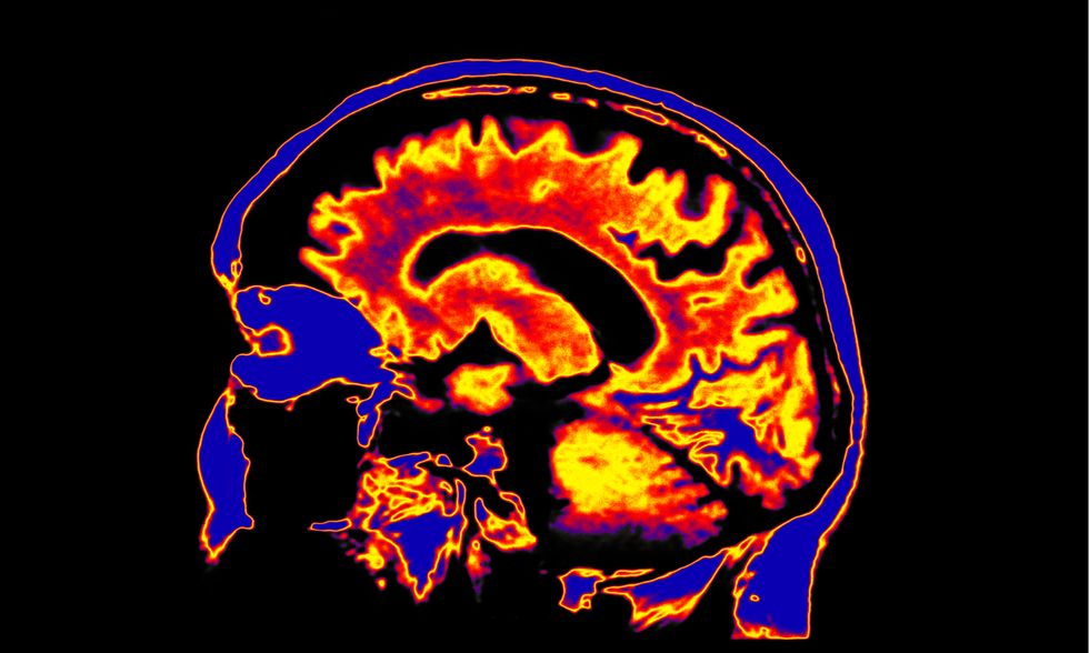 Mind and the quantum
