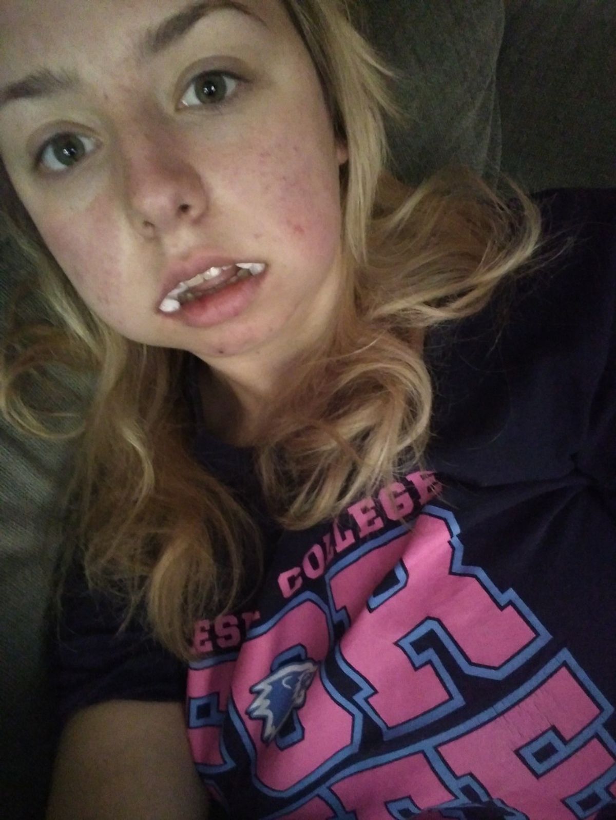 20 Stages of Getting Your Wisdom Teeth Taken Out